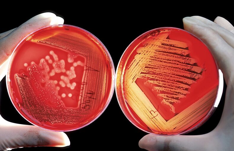 Candida albicans