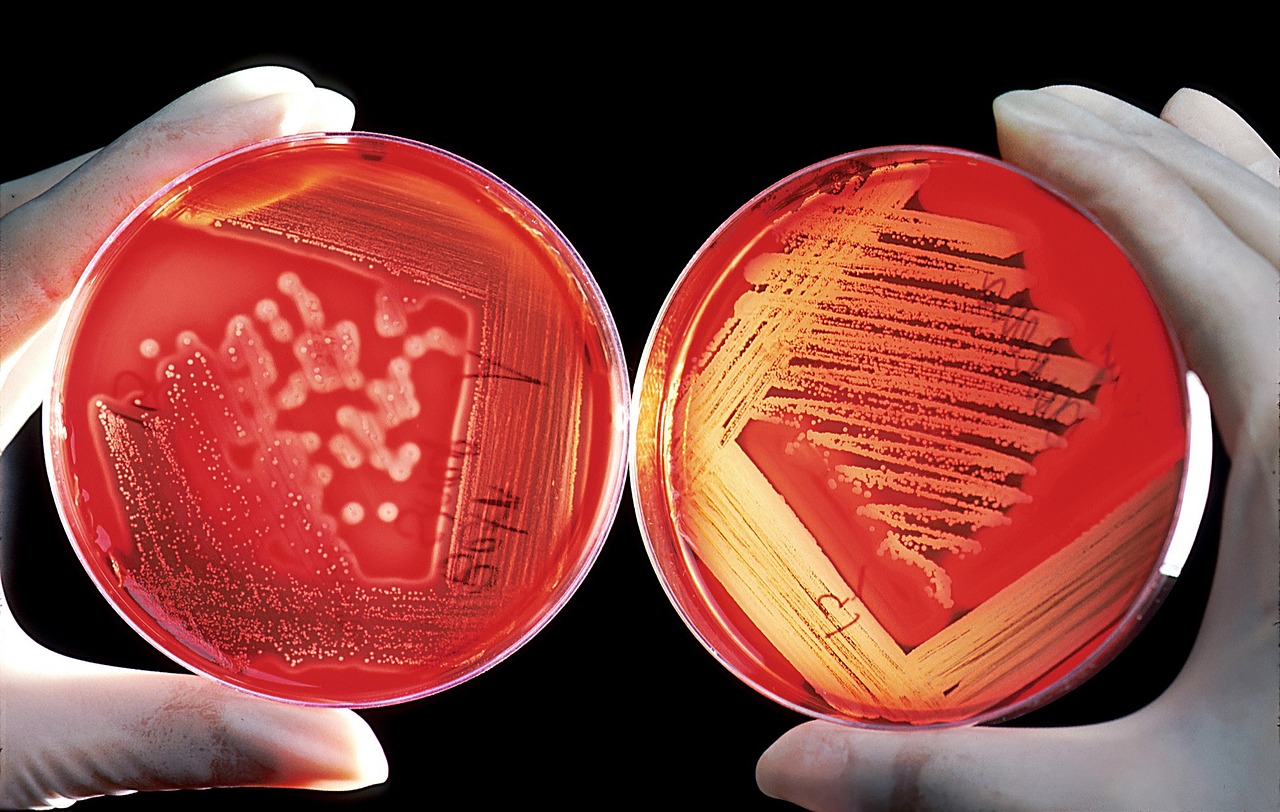 Candida albicans