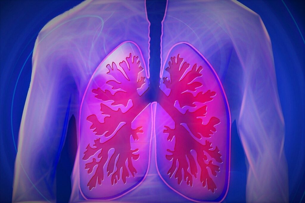 Sole, Inhalation, Soleinhalation